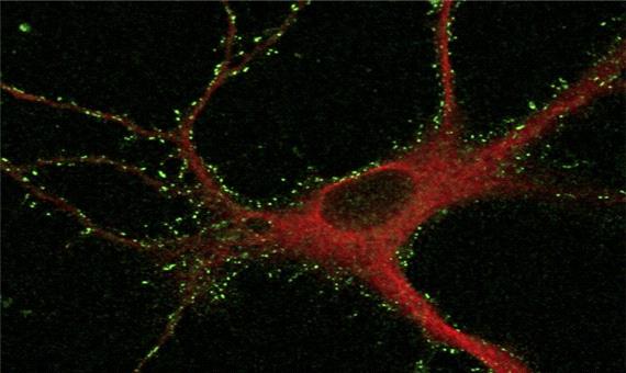 پروتئین‌هایی که اسرار حافظه و یادگیری را فاش می‌کنند